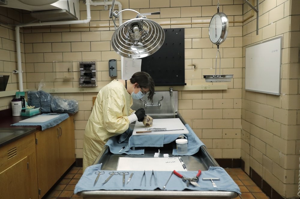 Dr. Desiree Marshall, director of Autopsy and After Death Services for University of Washington Medicine, examines the preserved heart of a person who died of COVID-19 related complications 