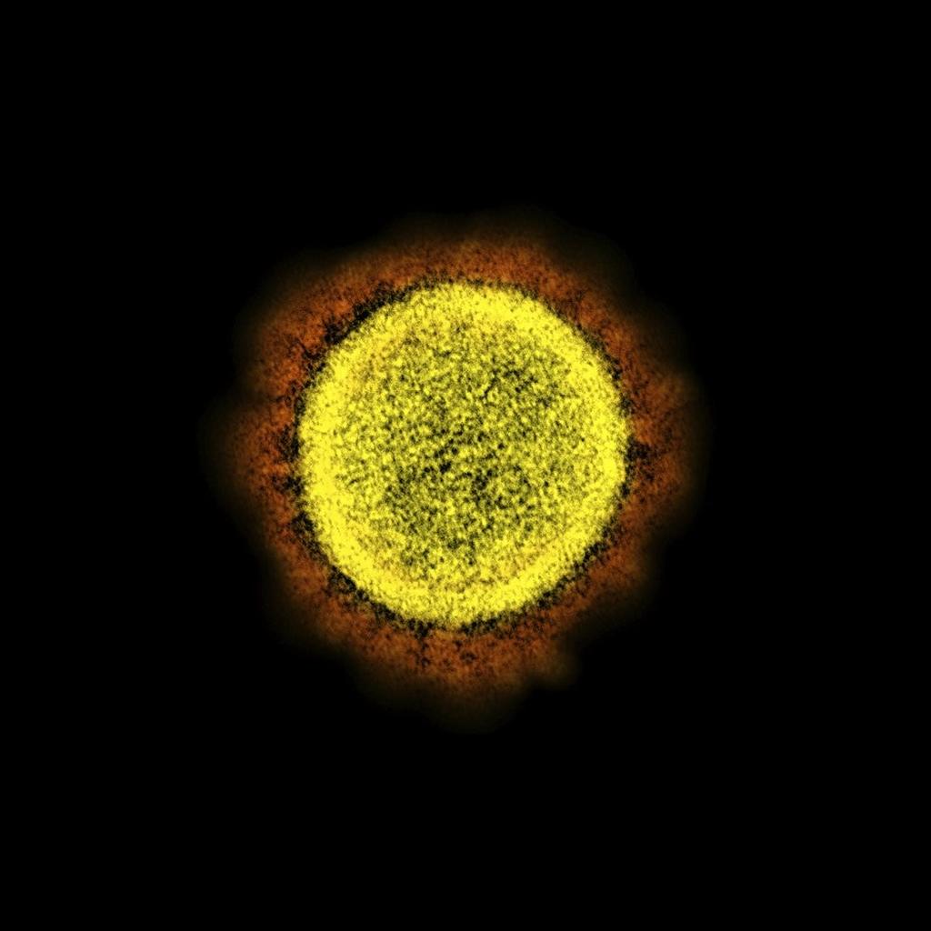 This 2020 electron micrsocope image made available by the National Institute of Allergy and Infectious Diseases shows a Novel Coronavirus SARS-CoV-2 particle isolated from a patient, in a laboratory in Fort Detrick, Md 