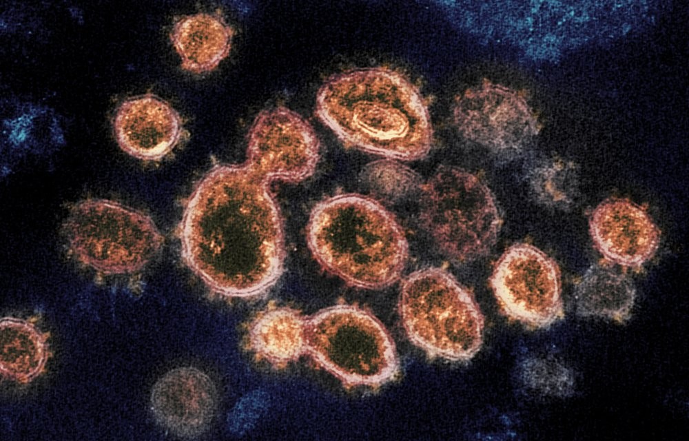 This 2020 electron microscope image provided by the National Institute of Allergy and Infectious Diseases - Rocky Mountain Laboratories shows SARS-CoV-2 virus particles which causes COVID-19, isolated from a patient in the U.S., emerging from the surface of cells cultured in a lab 