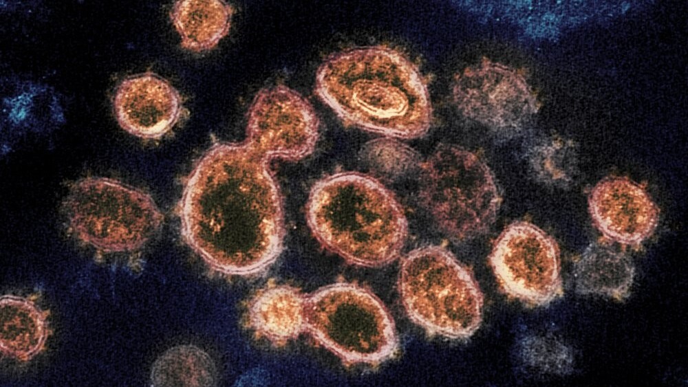 This 2020 electron microscope image provided by the National Institute of Allergy and Infectious Diseases - Rocky Mountain Laboratories shows SARS-CoV-2 virus particles which causes COVID-19, isolated from a patient in the U.S., emerging from the surface of cells cultured in a lab 
