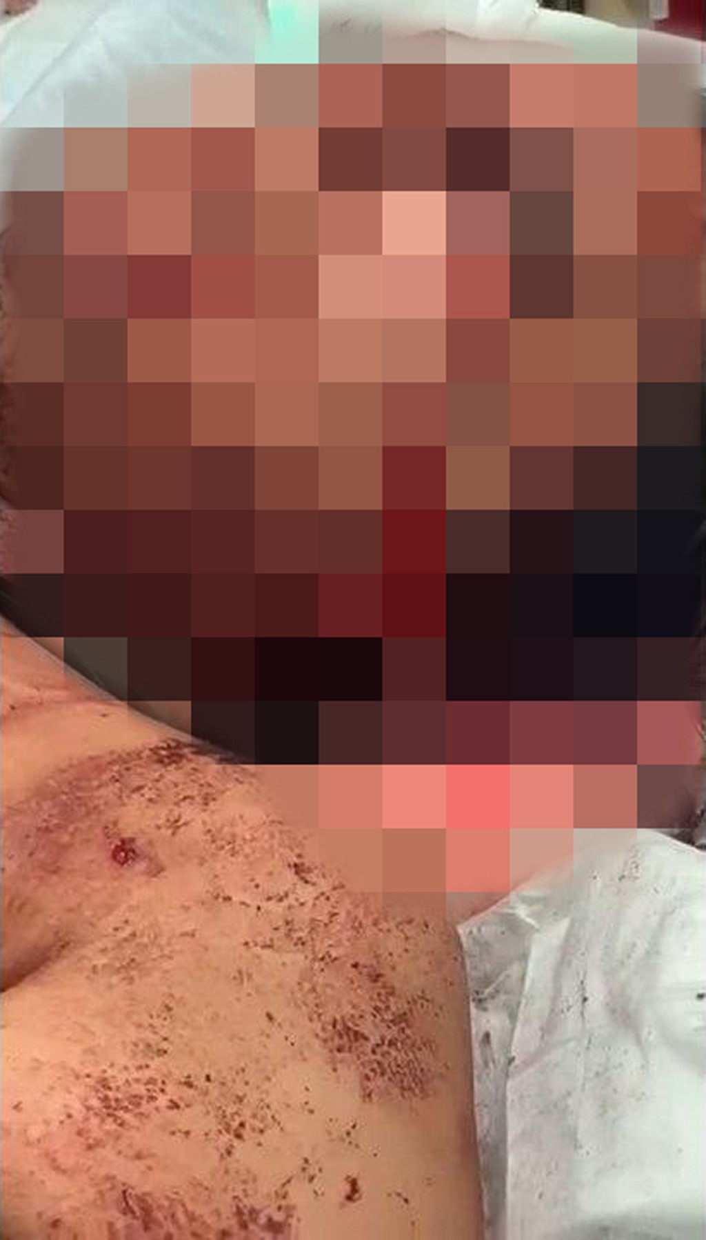 האישה אשר נדקה על ידי בעלה