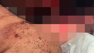 האישה אשר נדקה על ידי בעלה