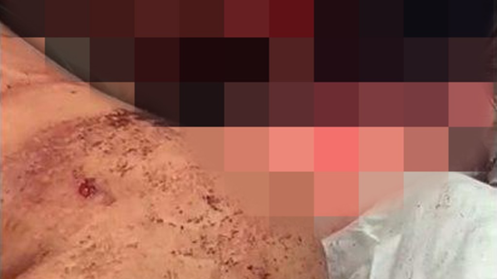 האישה אשר נדקה על ידי בעלה