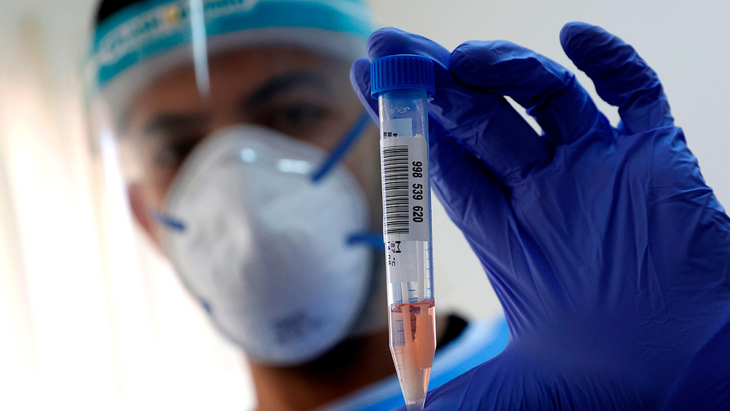 בדיקה בדיקות 