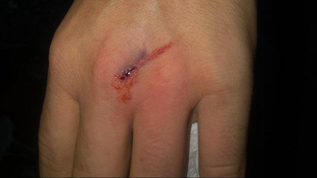 קבוצה של אנשים שישבו לחגוג בבר יין ברחוב עזה הותקפו על ידי פעילי ימין