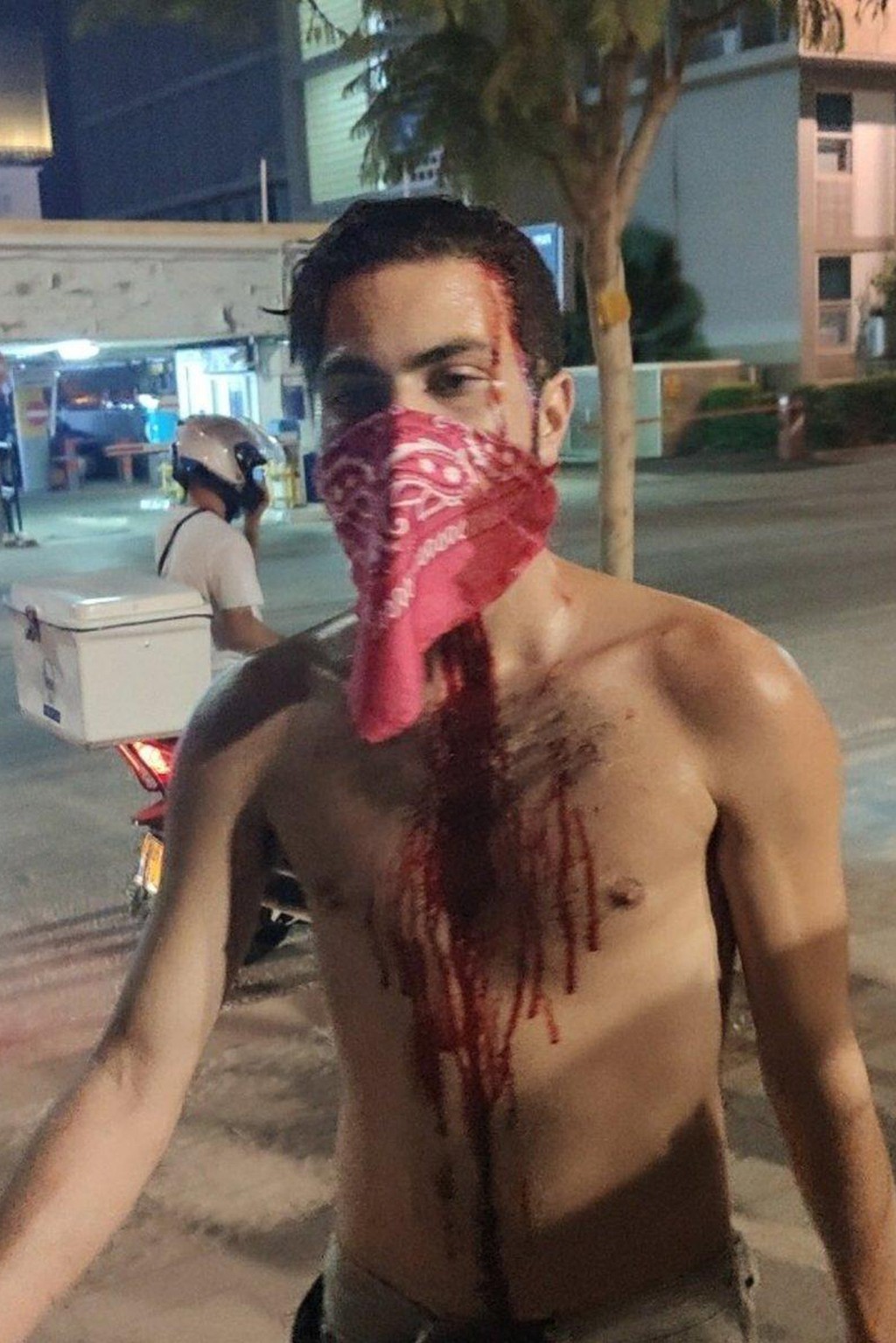 מפגין שהותקף בהפגנה בתל אביב