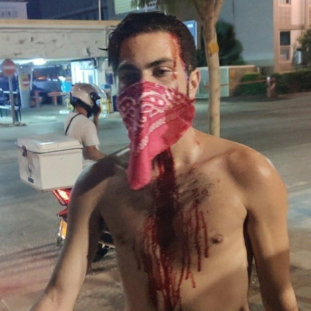 מפגין שהותקף בהפגנה בתל אביב