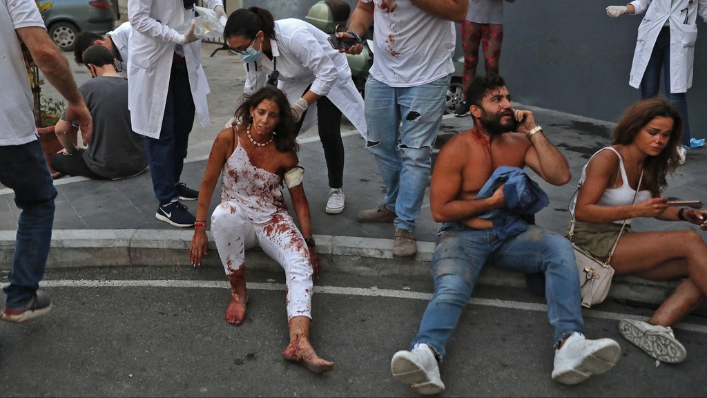  Beirut residents being treated for wounds sustained in the devastating explosion that rocked the city earlier this month 