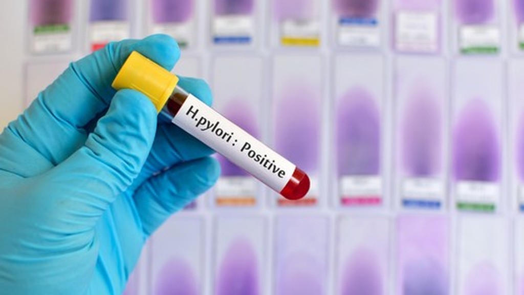 Фото: shutterstock хеликобактер пилори