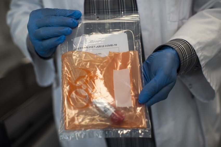Medical worker displays collected nose swab samples for the COVID-19 PCR test at the MontLegia CHC hospital, in Liege, Belgium