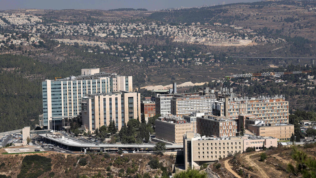 בית חולים הדסה עין כרם ירושלים
