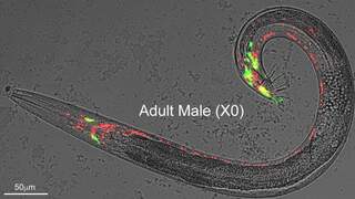 מערכת העצבים של התולעת תחת מיקרוסקופ. באדום: גרעיניהם של תאי העצב המשותפים לשני המינים, בירוק: תאי העצב הקיימים בזכרים בלבד