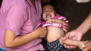 יסמין אניאילי תינוקת בת 22 חודשים שסובלת מרעב תת-תזונה בכפר לה סייבה ב גואטמלה
