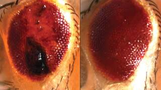 עין של זבוב פירות שהונדס כך שיפתח מחלה דמוית ALS. משמאל: צברי חלבונים פגומים המובילים לניוון דמוי ALS. מימין: העין חזרה למצב תקין בעקבות ביטוי של אחד מחלבוני ה"סומו"