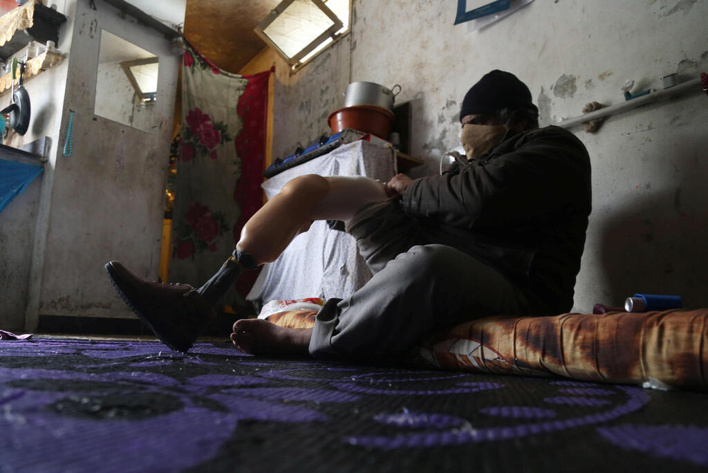 Syrian refugee Ahmad, 54, adjusts his artificial limb at his house in the town of Daraya, southeast of Beirut, Lebanon 
