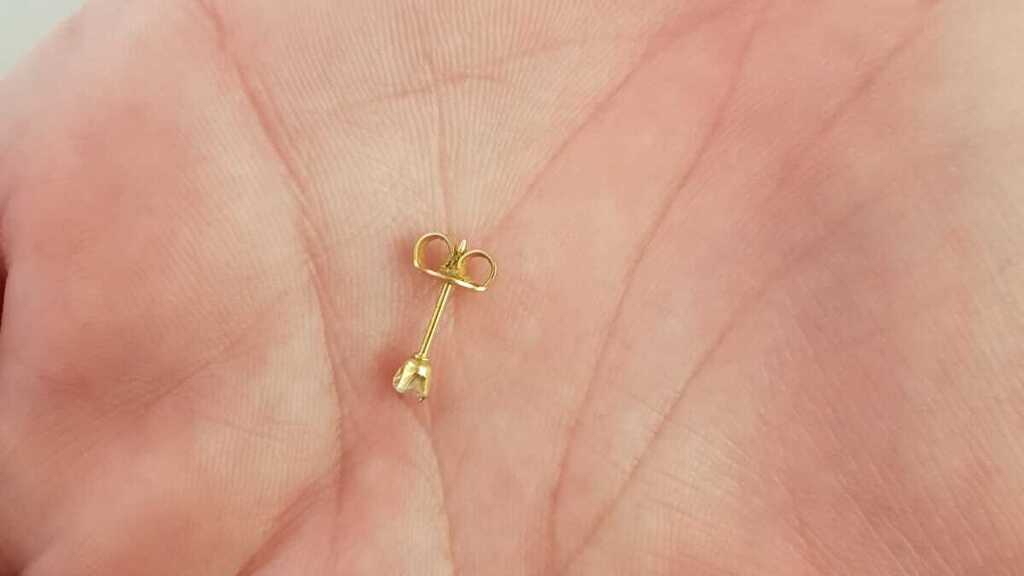 Сережка, извлеченная из уха малышки 