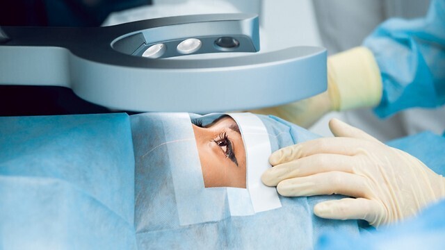 ניתוח קטרקט עין עיניים ראייה אילוס אילוסטרציה