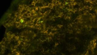 חיידקי סלמונלה (ירוק בוהק) הנמצאים בתוך מקרופאגים (צהוב-חום) של עכבר