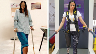 ליאורה קקון לפני ואחרי ניתוח כריתת הרגל