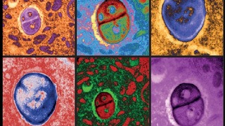 חיידקים המתארחים בתאי מלנומה תחת מיקרוסקופ אלקטרונים (התמונות עברו צביעה דיגיטלית)