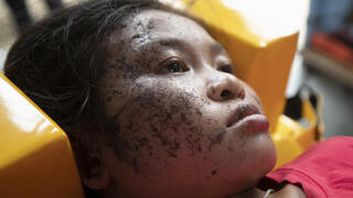 תאילנד פליטים מגיעים מ מדינת קארן ב מיאנמר ילדה פצועה