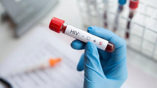 איידס HIV בדיקת דם