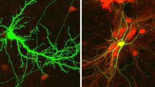 תאי עצב של עכבר תחת מיקרוסקופ. תא עצב מעכב (מימין) ותא עצב מעורר (שמאל)
