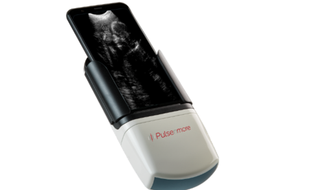 Прибор для домашнего УЗИ беременных фирмы PulsenMore