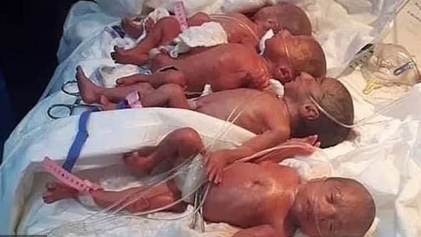 חלימה סיסה מאלי ילדה תשעה תינוקות ב בית חולים ב מרוקו