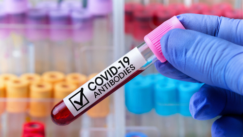 коронавирус серологический тест антитела  