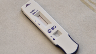 שר הבריאות ניצן הורוביץ עובר בדיקת קורונה מהירה במתחם מד"א בירושלים