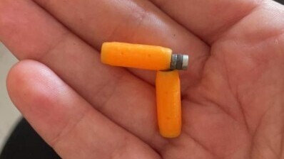 Извлеченные из кишечника мальчика магнитики (Фото: пресс-служба больницы "Каплан") Извлеченные из кишечника мальчика магнитики