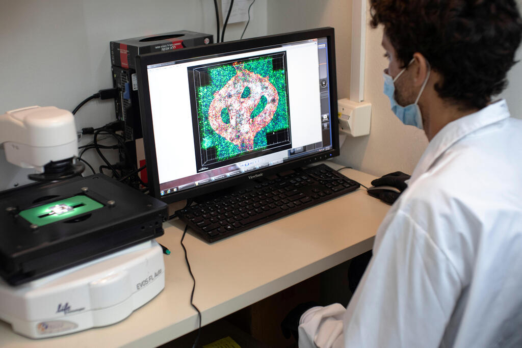 Israeli researcher examines a microscope image of a blood vessel tube surrounded by cancer tissues, as part of a brain cancer research that uses patients' cells to make 3D printed models of tumors, at Tel Aviv University
