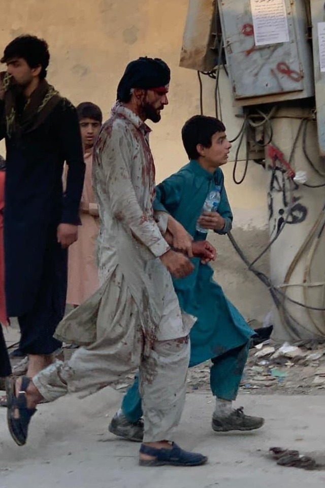 Wounded being evacuated following blast in Kabul פינוי פצועים פיגוע מחוץ לנמל התעופה ב קאבול אפגניסטן