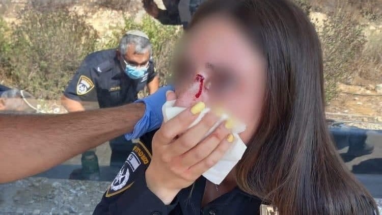 שוטרת הותקפה בפניה במהלך אכיפת עטיית מסיכה בתחבורה ציבורית סמוך לירושלים