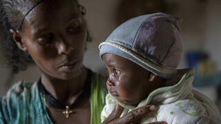 אתיופיה רעב תיגראי ילד הסובל מ תת תזונה 