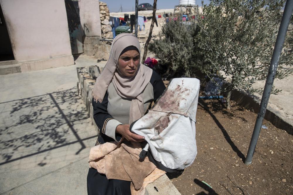 Palestinian mother Baraa Hamamdi holds her injured son's bloodstained clothes that was left behind after Mohammed was evacuated to an Israeli hospital, following a settlers attack from nearby settlement outposts 