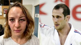 מרגו פינו אחרי התקיפה