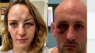 הפנים הפגועות של שמיט ופינו