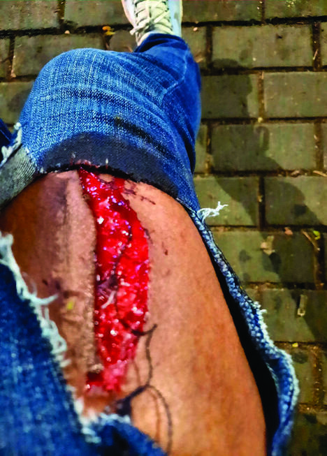  Кровавая рана - результат нападения кабана 