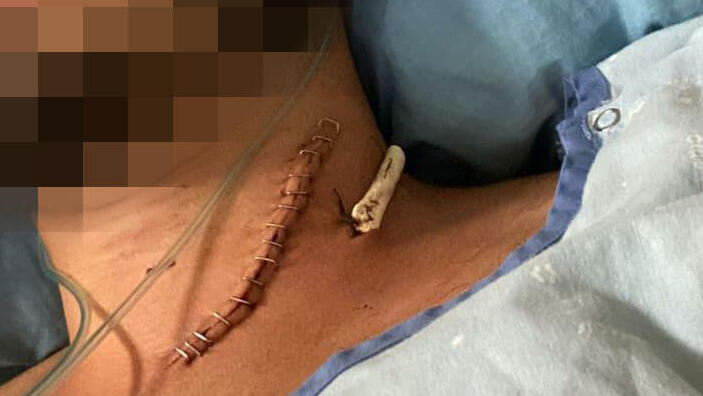 הלוחם שנפצע