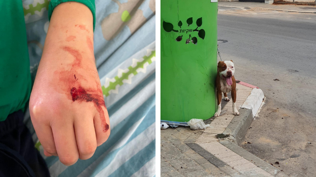 Рука Итая с укусом и атаковавший пес.