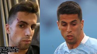 ז'ואאו קנסלו בתיעוד פניו החבולות