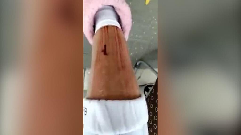 Рана на ноге Нэнси Шнайдер אבן נזרקה על קשישה בזמן ויכוח על חניה