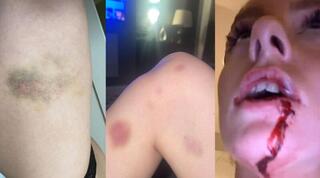 החבלות על הארייט רובסון