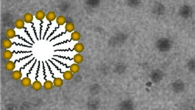 מיצלות תחת מיקרוסקופ אלקטרונים. משמאל – המבנה של המיצלה מוגדל פי 10 (בצהוב - הראש אוהב המים של הליפיד, בשחור - הזנב אוהב השמן). הקו מימין מציין גודל של 0.3 אלפיות מ"מ
