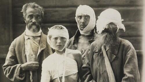 Jews injured in one of the pogroms near Kyiv (Photo: Israel National Library) פצועים יהודים בעקבות פוגרום בעיירה חודורקוב, אוקראינה. מתוך אלבום תצלומים בעקבות הפרעות
