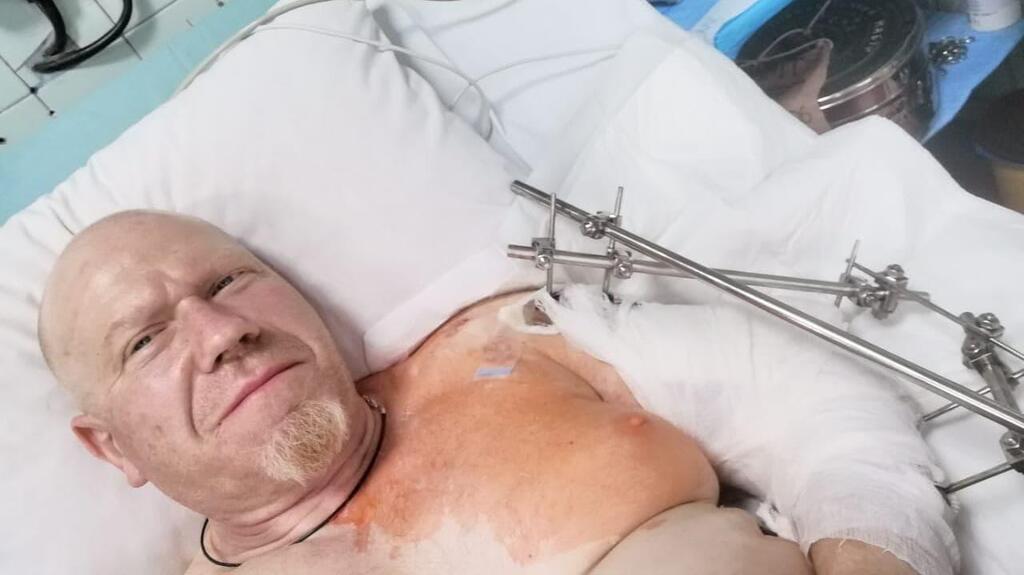 Anatoly - soldier in Ukrainian army - in his hospital bed (Photo: Ynet) אנטולי