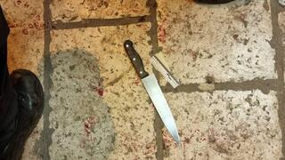 פיגוע דקירה בעיר העתיקה בירושלים שוטרים סכין