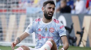 ברונו פרננדש